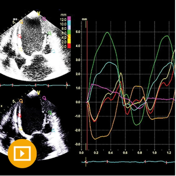 Echocardiography – A Comprehensive Review 2022 (Videos)