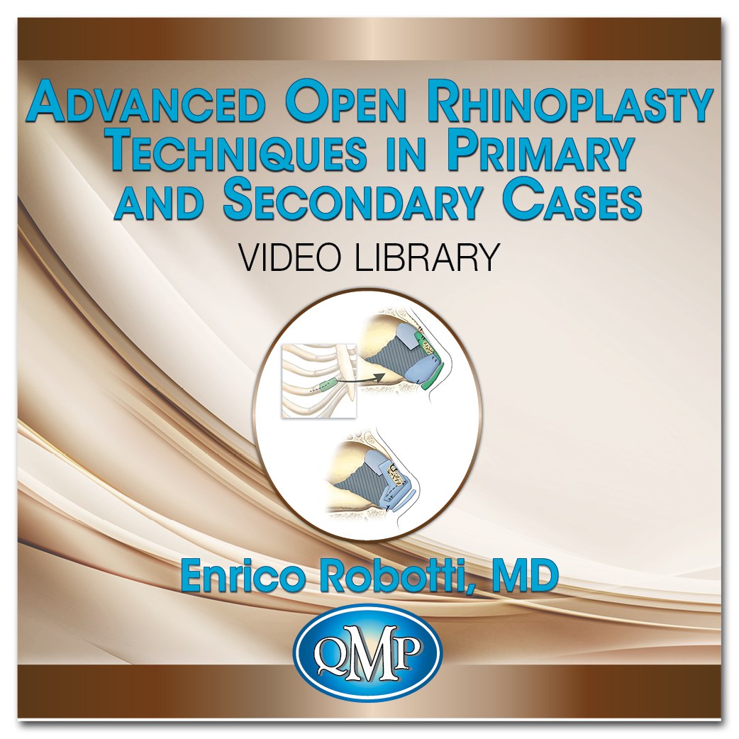 Advanced Open Rhinoplasty Techniques in Primary and Secondary Cases