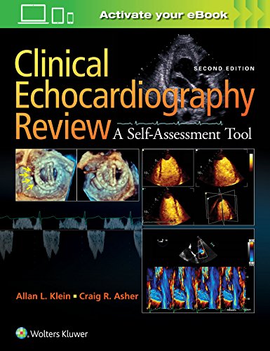 Clinical Echocardiography Review A Self-Assessment Tool, Second Edition