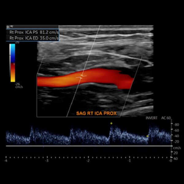 Oakstone Society for Vascular Medicine Comprehensive Review of Vascular Ultrasound Interpretation and Registry Preparation 2023