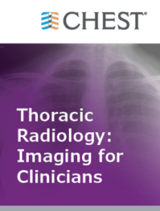 Thoracic Radiology Imaging for Clinicians (Chestnet) 2021