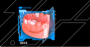 Veneers, inlay, onlay, crowns full protocols