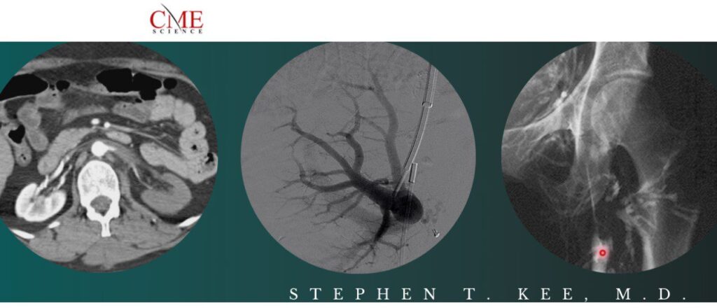 CME Science Interventional Radiology Stephen T. Kee, M.D 2021 (CME VIDEOS)