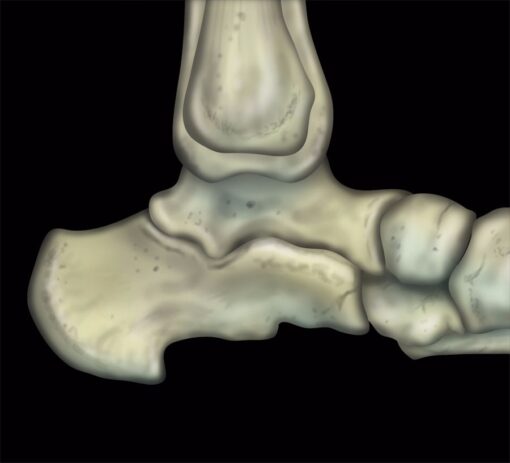 MRI Online MRI Mastery Series: Ankle 2017