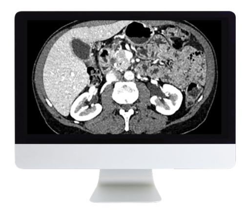 ARRS Gastrointestinal Imaging Online Course 2019 (CME VIDEOS)