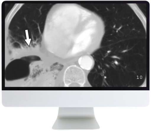 ARRS Radiology Review: Multispecialty Cases 2019 (CME Videos)