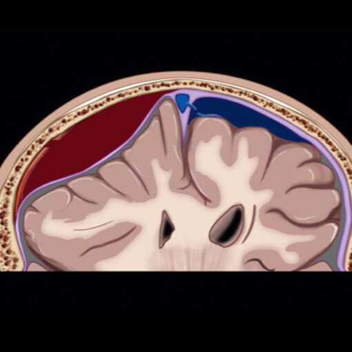 MRI Online Emergency Series: Emergency Neuroimaging: Brain 2021