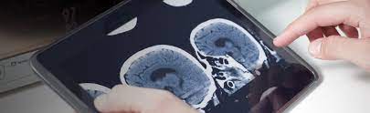 Radiopaedia NEURORADIOLOGY UPDATE COURSE Videos