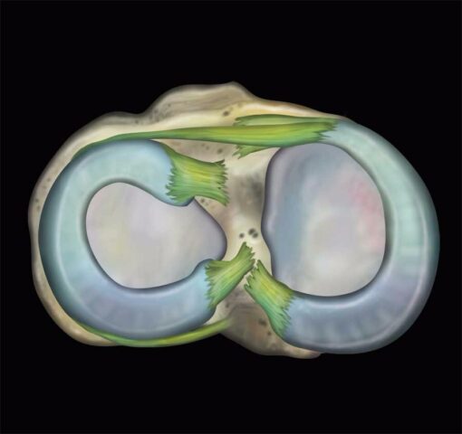 MRI Online MRI Mastery Series: Knee 2021