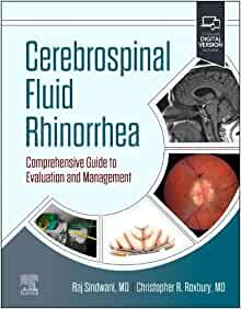 Cerebrospinal Fluid Rhinorrhea: Comprehensive Guide to Evaluation and Management