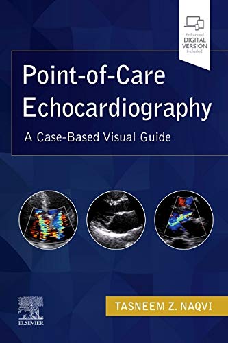 Point-Of-Care Echocardiography: A Clinical Case-Based Visual Guide (Videos Only, Well Organized)
