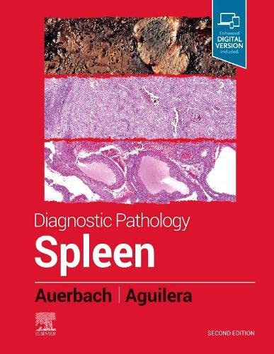 Diagnostic Pathology: Spleen, 2nd Edition (Original PDF From Publisher)