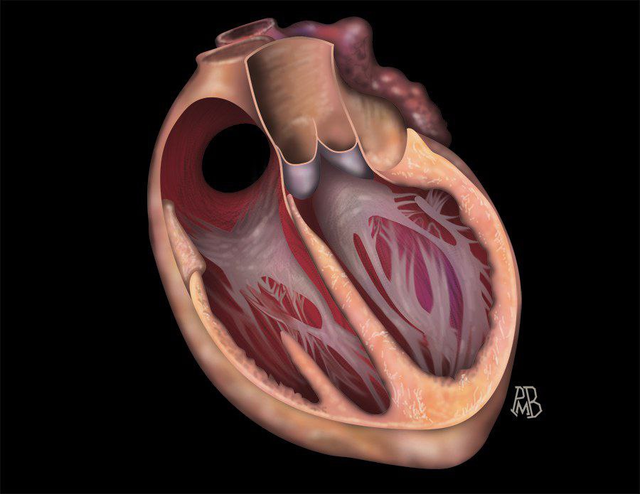 MRI Online Mastery Series: Fundamentals of Cardiac MRI 2021