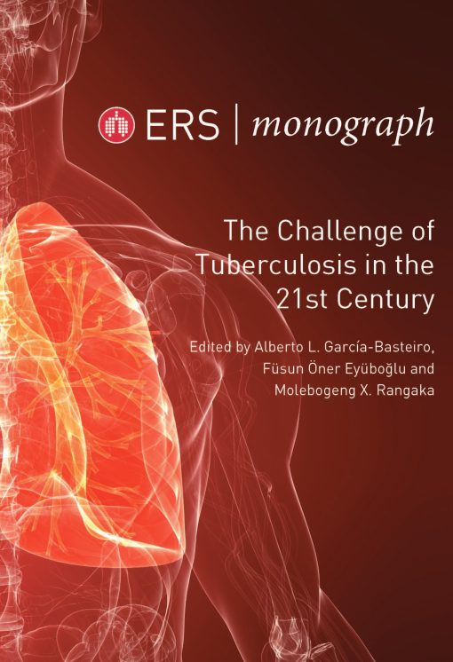 The Challenge of Tuberculosis in the