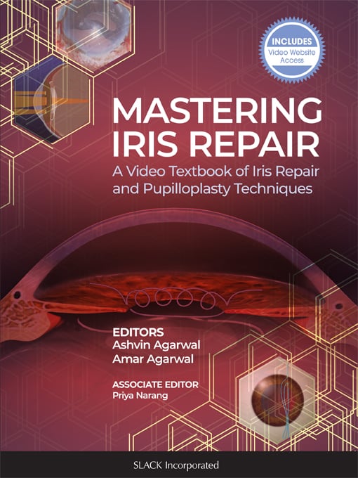 Mastering Iris Repair