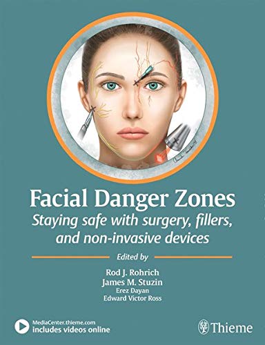 Facial Danger Zones Staying Safe With Surgery, Fillers, And Non-Invasive Devices (PDF+Videos)