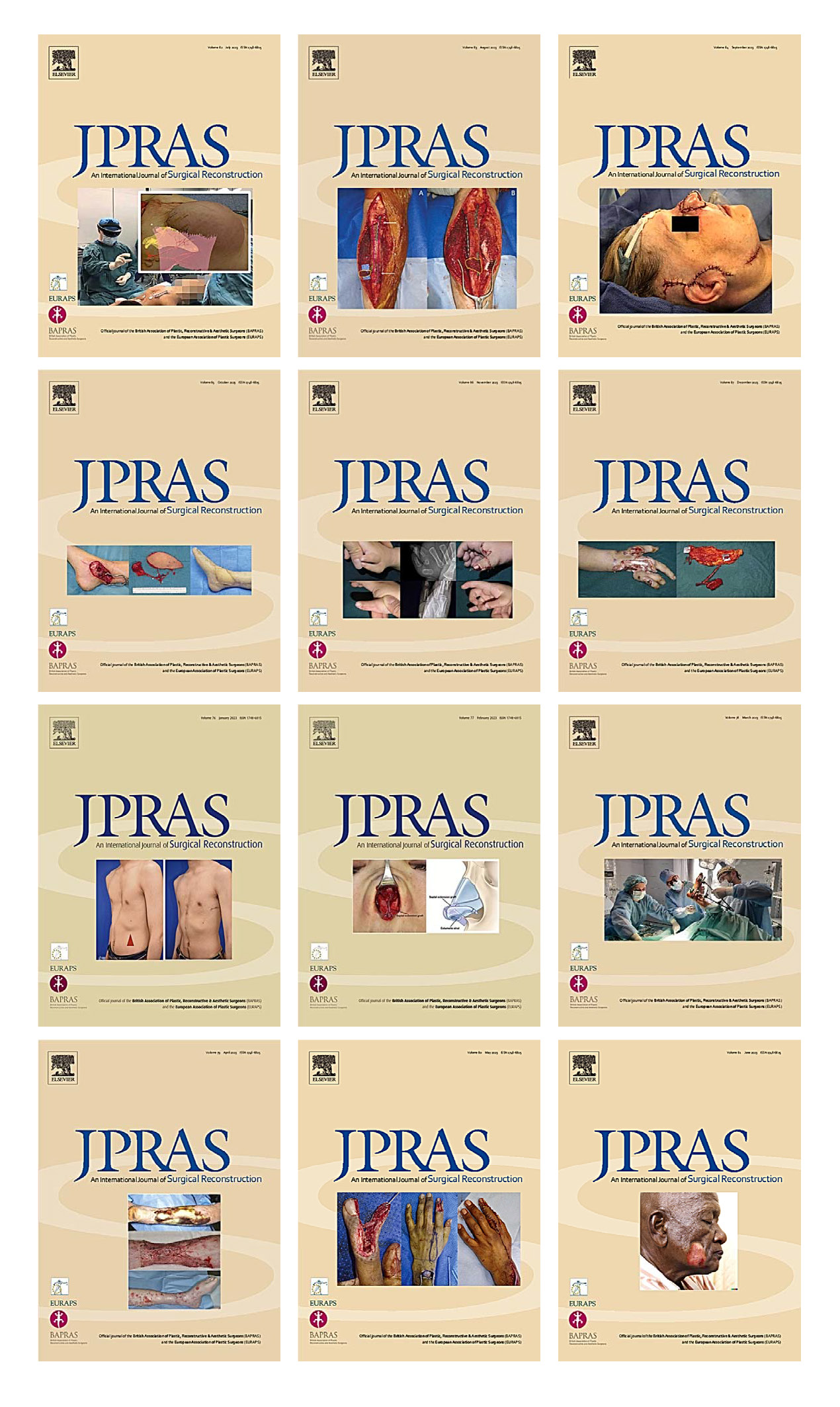 Journal Of Plastic, Reconstructive & Aesthetic Surgery 2023 Full Archives (True PDF)