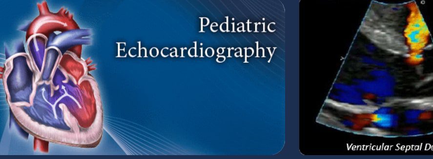 Pediatric Echocardiography Review from pegasus
