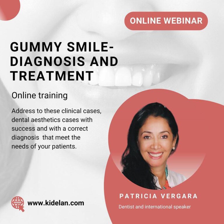 Gummy Smile – Diagnosis and Treatment
