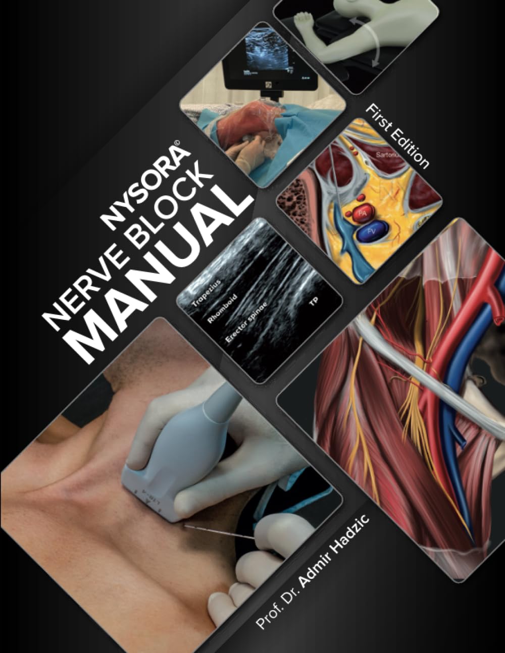 NYSORA Nerve Block Manual (Original PDF From Publisher)
