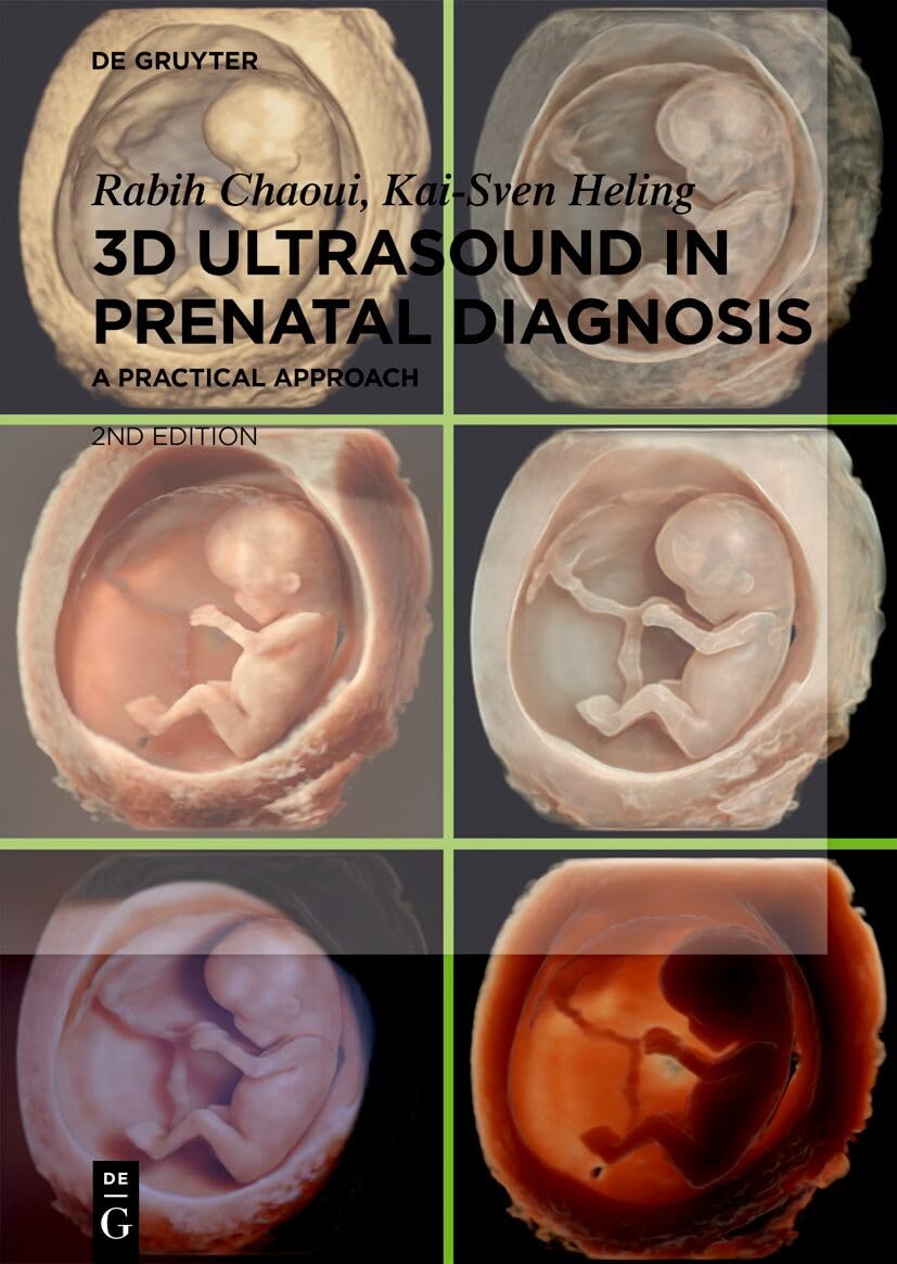 3D Ultrasound in prenatal diagnosis by Rabih Chaoui 2nd edition original PDF 2024