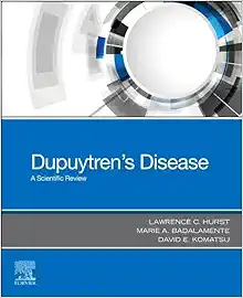 Dupuytren’s Disease: A Scientific Review