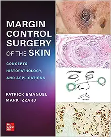 Margin Control Surgery Of The Skin: Concepts, Histopathology, And Applications (Original PDF From Publisher)