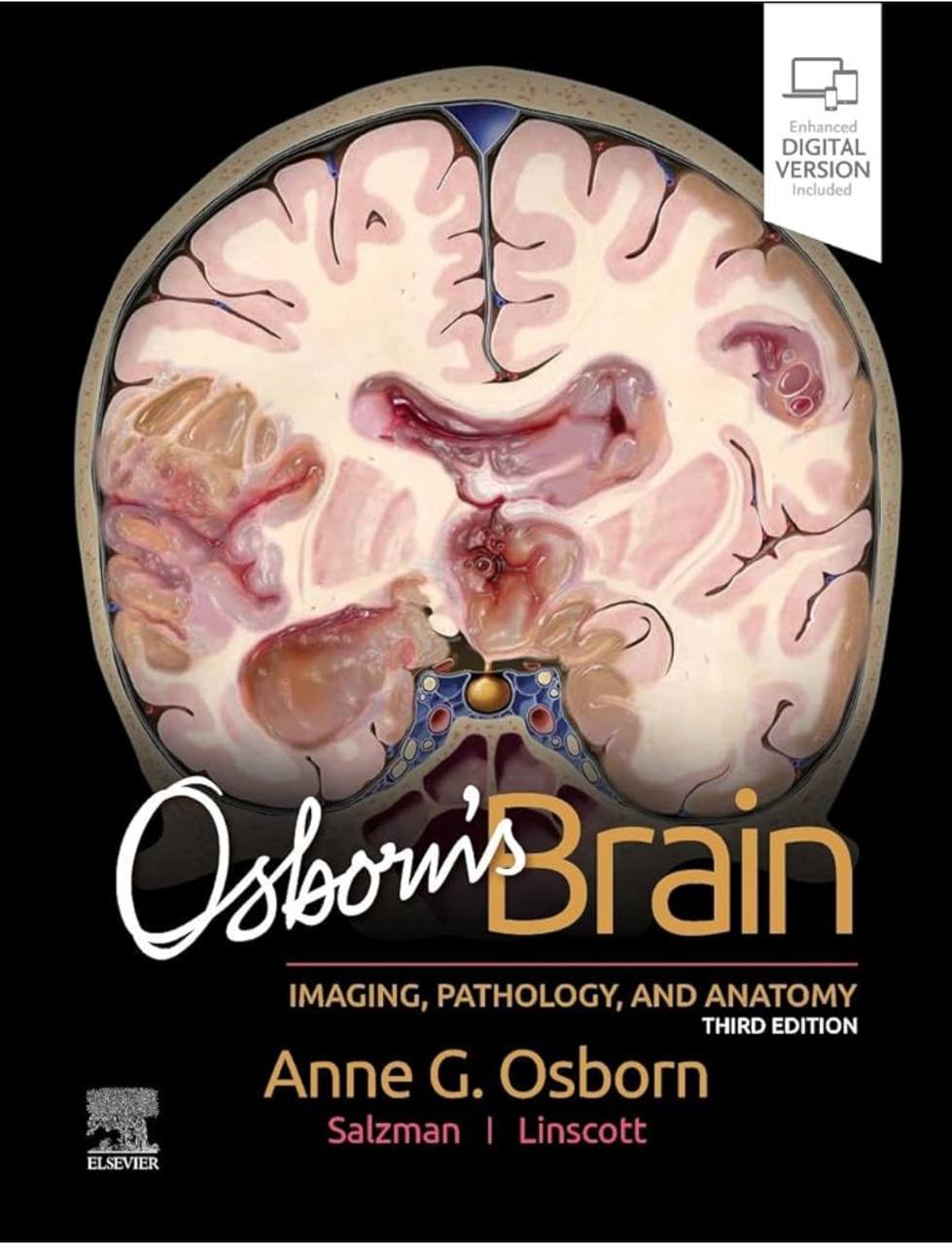 Osborn’s Brain: Imaging,Pathology and Anatomy 3e 2024 Original PDF