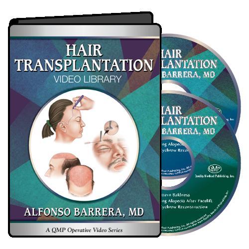 QMP Hair Transplantation 2017 (Videos)