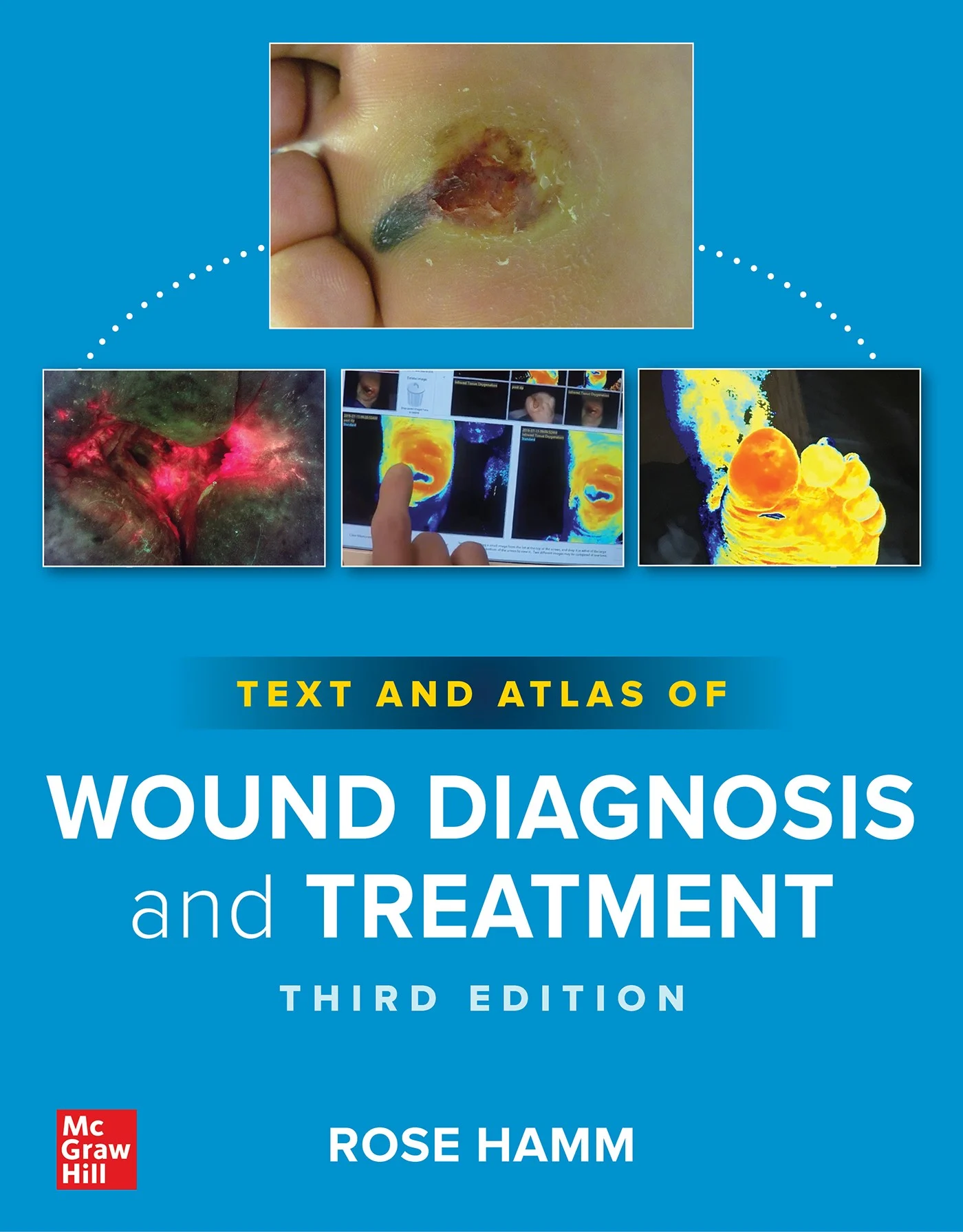 Text And Atlas Of Wound Diagnosis And Treatment, 3rd Edition (Original PDF From Publisher)