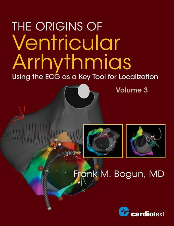 The Origins Of Ventricular Arrhythmias: Using The ECG As A Key Tool For Localization, Volume 3 (EPUB)The Origins of Ventricular Arrhythmias: Using the ECG as a Key Tool for Localization is the third volume in a case-based series highlighting the importance of the 12-lead ECG when mapping and treating patients with ventricular arrhythmias.This volume features 30 cases, presented as a series of “unknowns” to teach electrophysiology and cardiology fellows-in-training the concept of connecting ventricular arrhythmias’