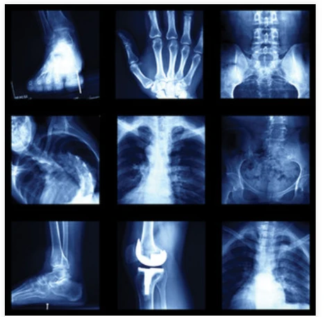 UCSF Imaging: Core and Extremities 2024