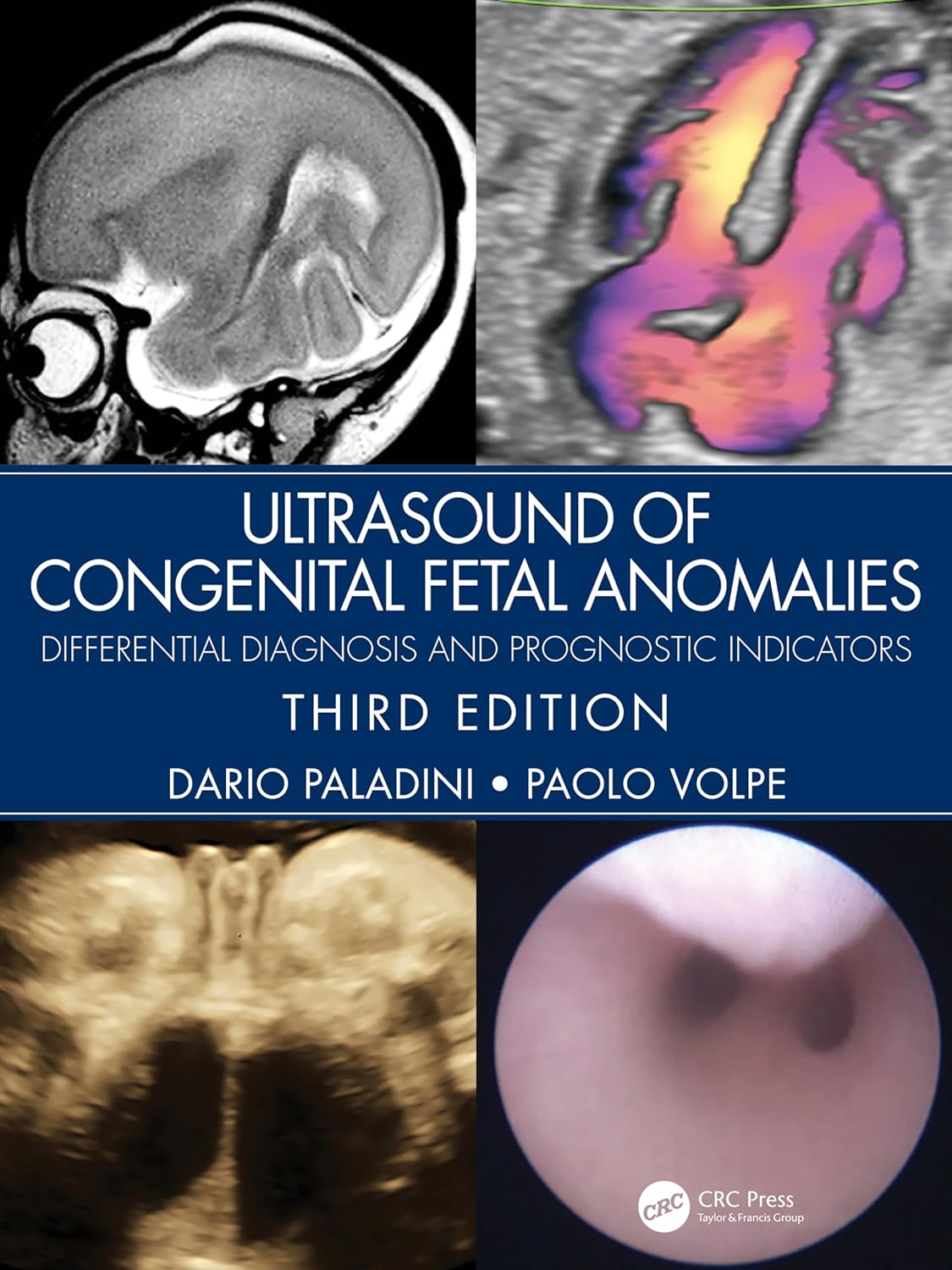 Ultrasound Of Congenital Fetal Anomalies: Differential Diagnosis And Prognostic Indicators, 3rd Edition