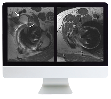 ARRS Controversies In Hip And Pelvis Imaging 2016 (CME VIDEOS)