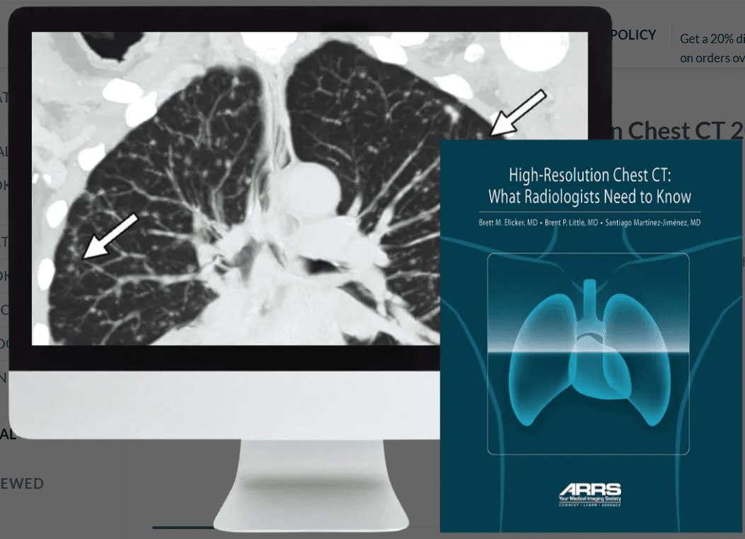 ARRS High-Resolution Chest CT 2024