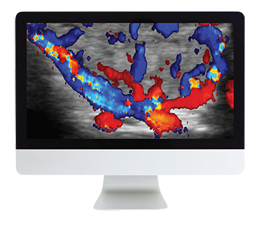 ARRS Thyroid Imaging 2019 (CME VIDEOS)