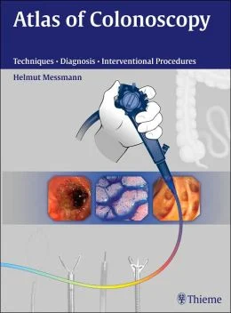 Atlas Of Colonoscopy: Examination Techniques And Diagnosis