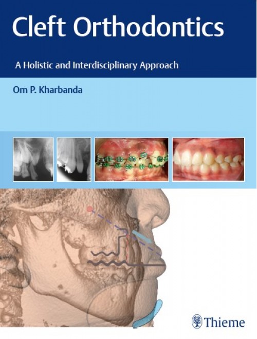 Cleft Orthodontics A Holistic And Interdisciplinary Approach (Original PDF From Publisher)