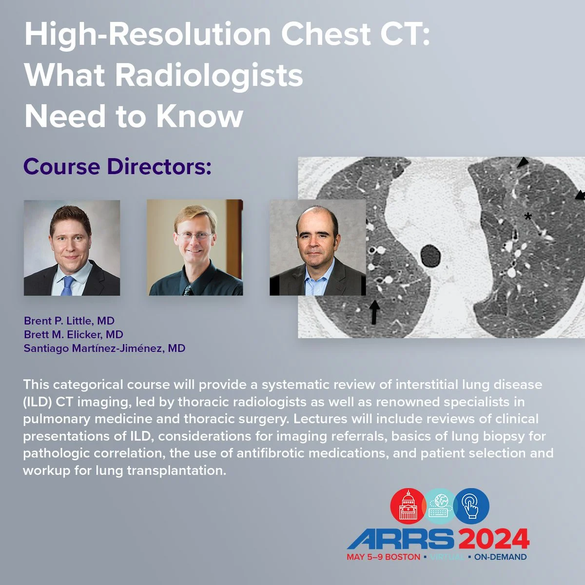 High-Resolution Chest CT: What Radiologists Need To Know – ARRS 2024 (Videos)