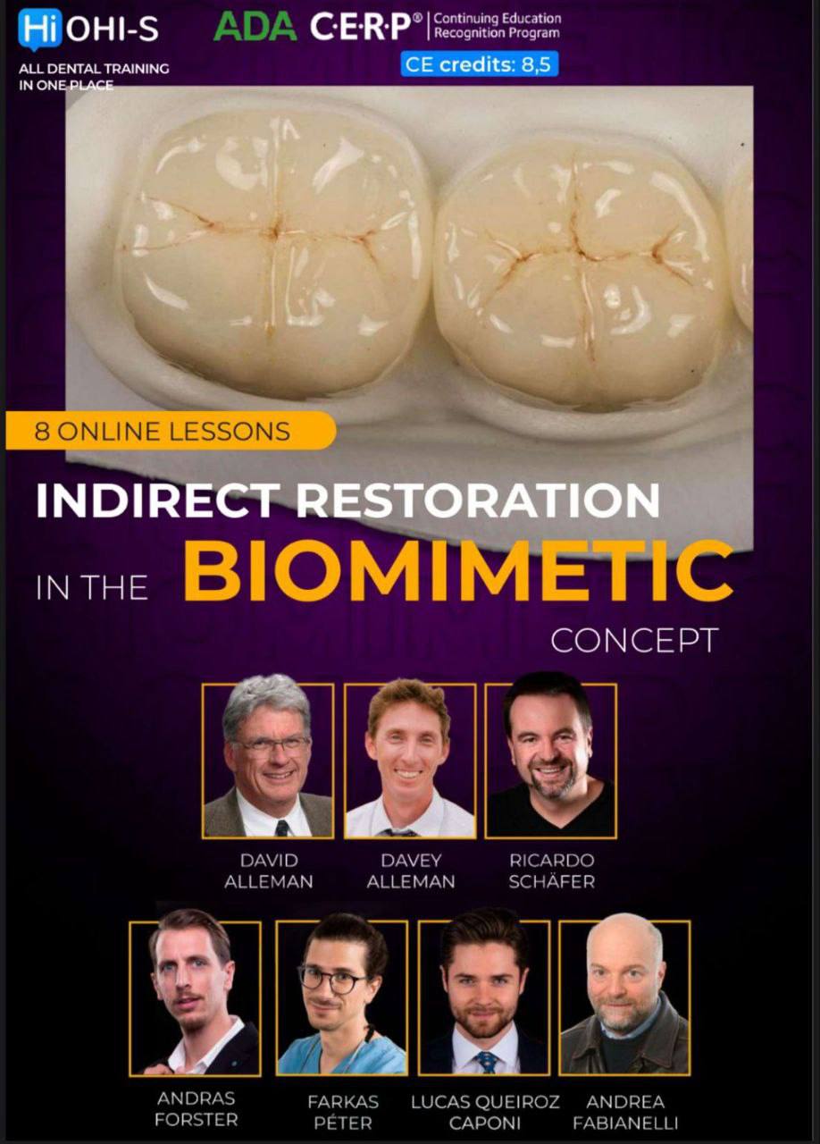 OHI-S Indirect Restoration in the Biomimetic Concept