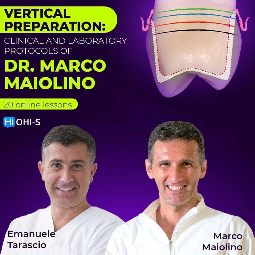 OHI-S Vertical Preparation: Team Approach, Clinic+Dental Lab – Marco Maiolino, Emanuele Tarascio