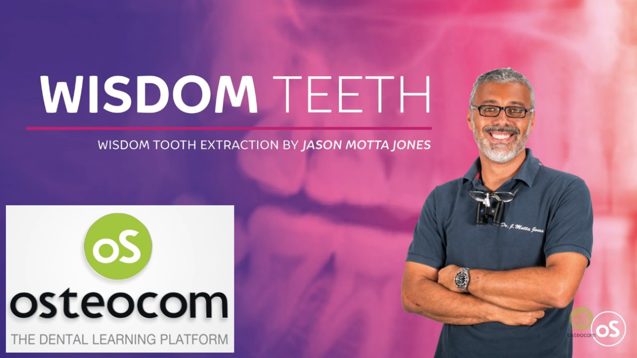 Osteocom Wisdom Tooth Extraction Jason Motta Jones