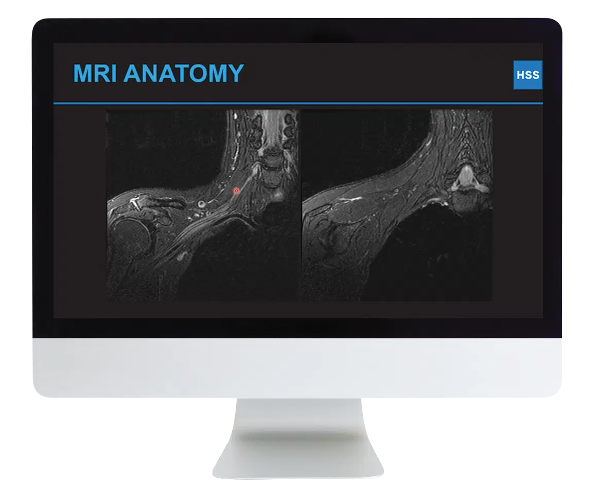 Plexus and Peripheral Nerve Imaging 2024