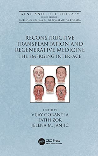 Reconstructive Transplantation And Regenerative Medicine: The Emerging Interface (Gene And Cell Therapy) (Original PDF From Publisher)