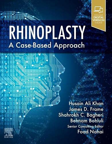 Rhinoplasty: A Case-Based Approach (Original PDF From Publisher)