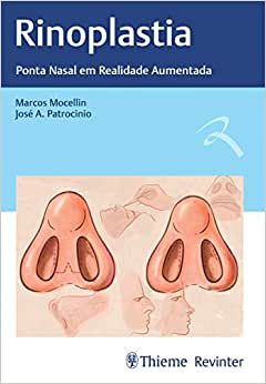 Rinoplastia: Ponta Nasal Em Realidade Aumentada (Original PDF From Publisher)