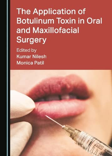 The Application Of Botulinum Toxin In Oral And Maxillofacial Surgery (Original PDF From Publisher)