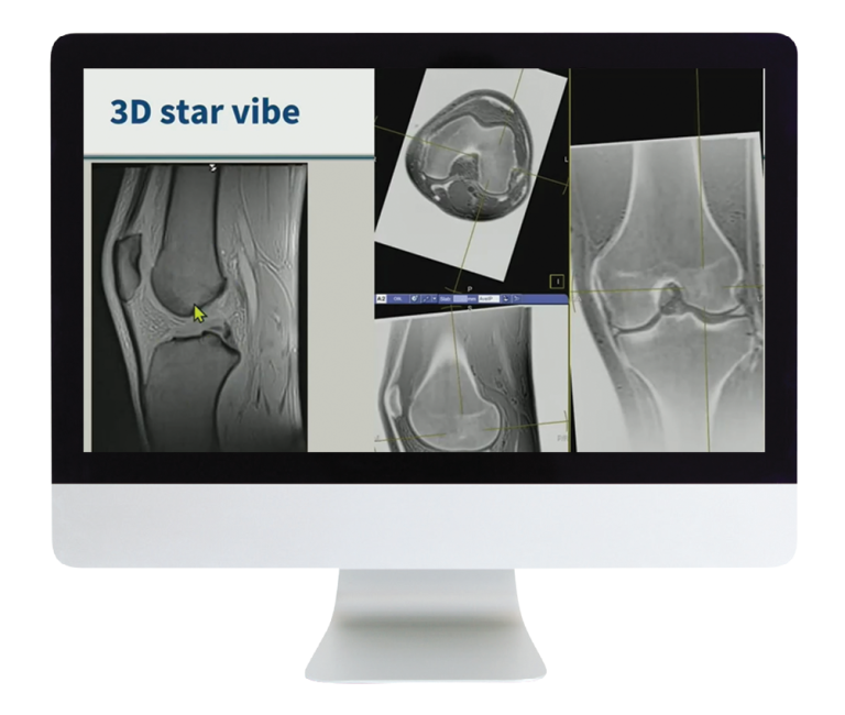 American Roentgen Ray Society 3D MR Imaging of Joints with Arthroscopy Correlations 2023