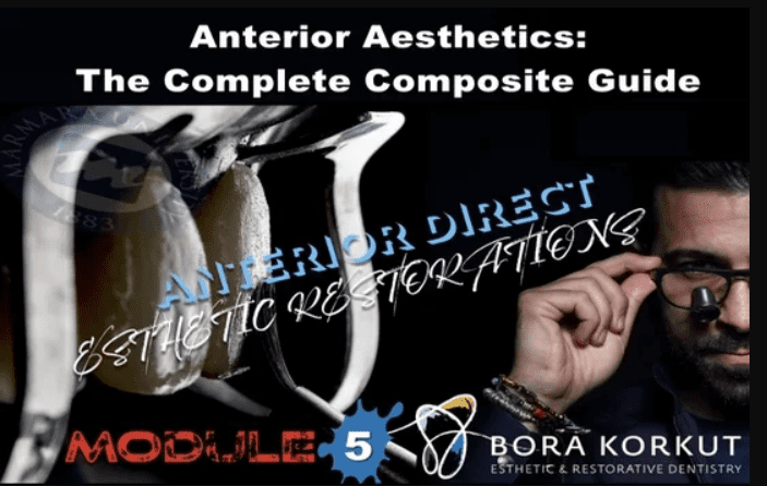 Anterior Aesthetics The Complete Composite Guide