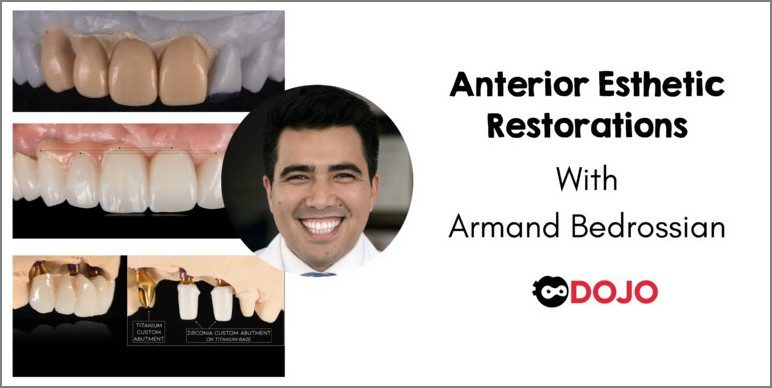 Anterior Implant Esthetic Restorations